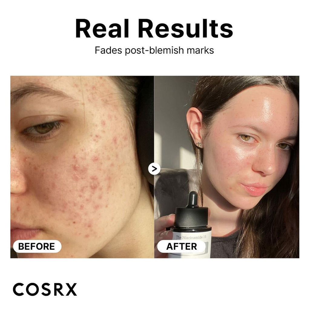 Gesichtscreme cosrx the niacinamide - schönheit hautpflege