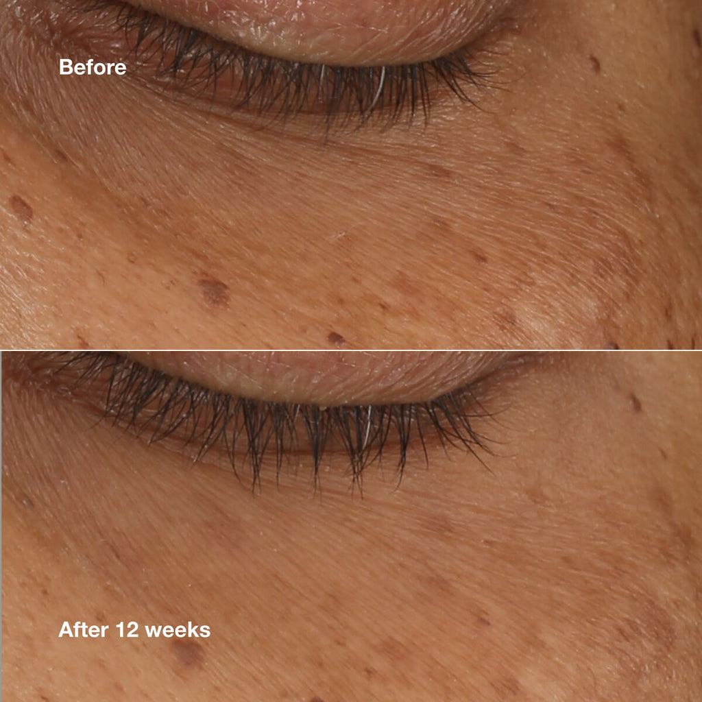 Illuminierendes serum clinique all about eyes 10 ml